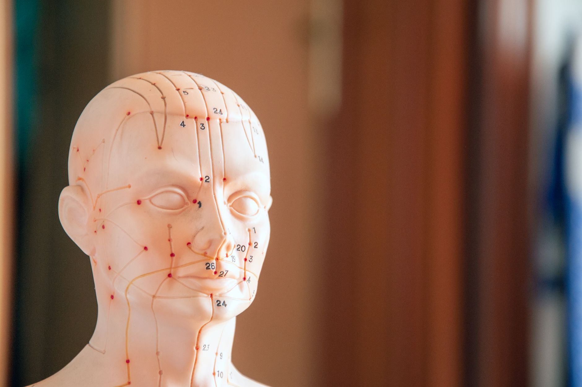 Best Acupuncture Points for Relieving Headaches