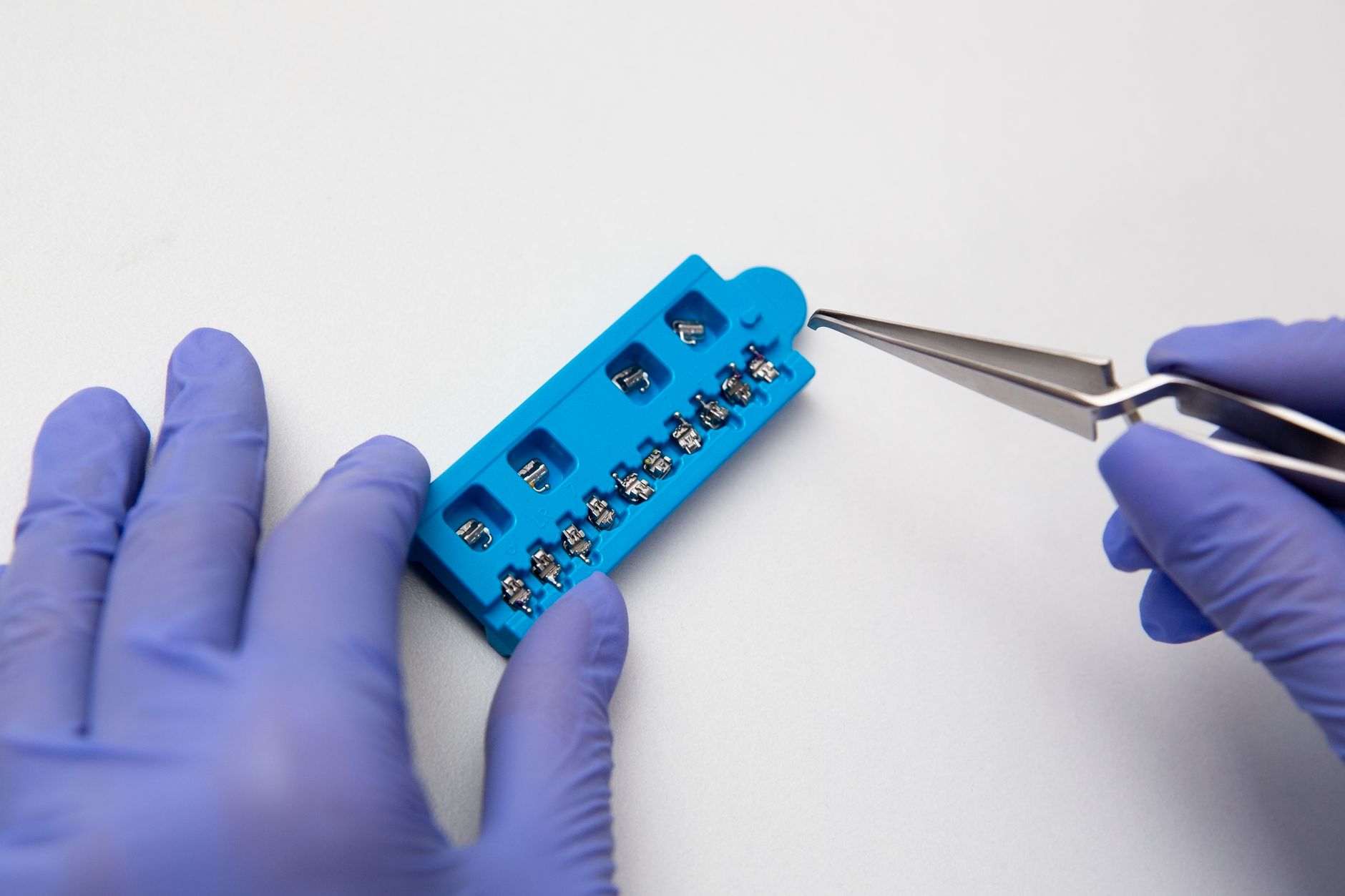 What to Expect During Orthodontic Treatments in Oakville