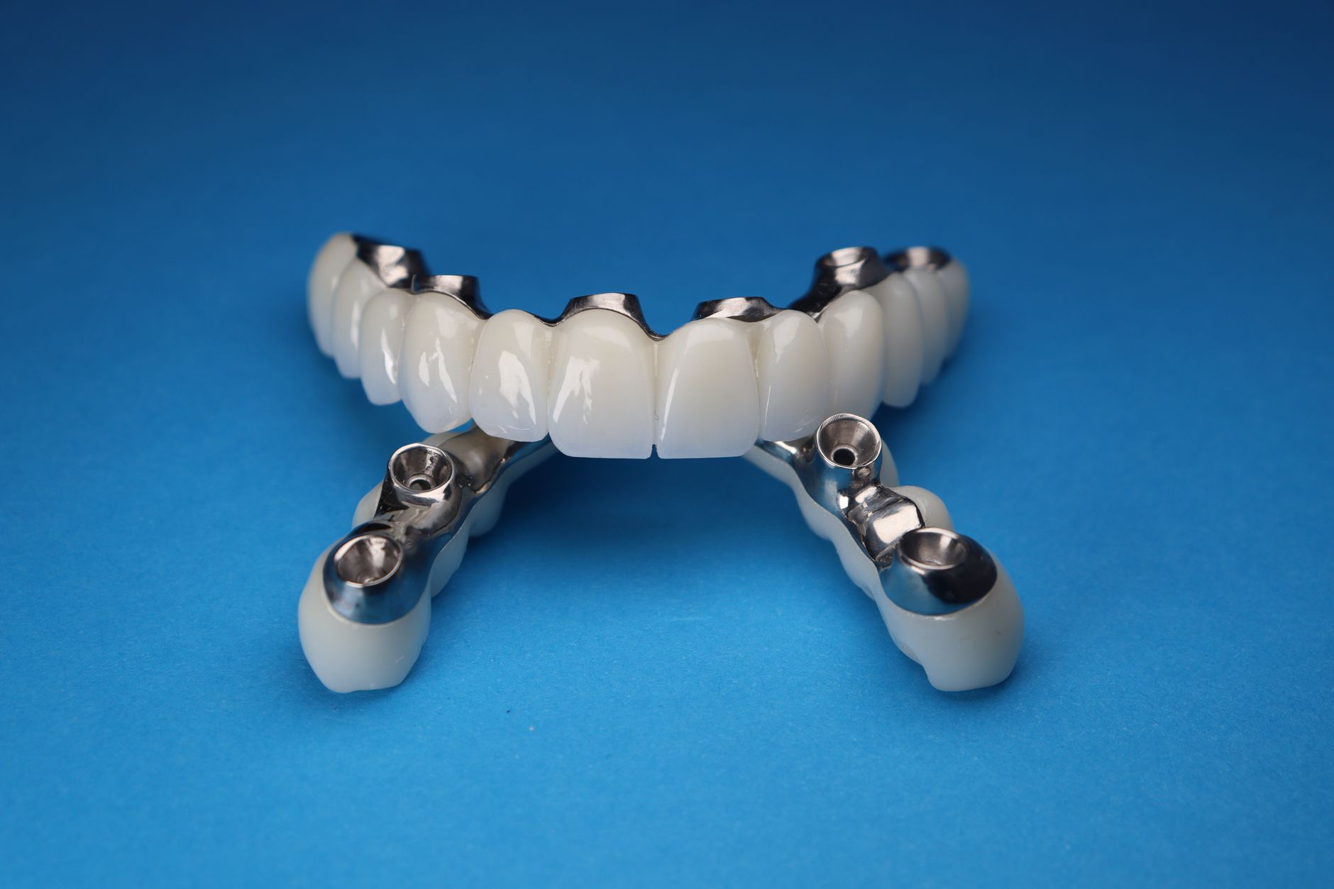 Your Complete Guide to Dental Implants and Aesthetic Restorations